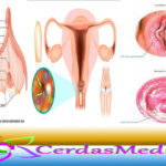 Mengenal Penyebab Vulvovaginitis Beserta Gejalanya